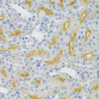Immunohistochemistry - UBE2B Antibody (144-06315)