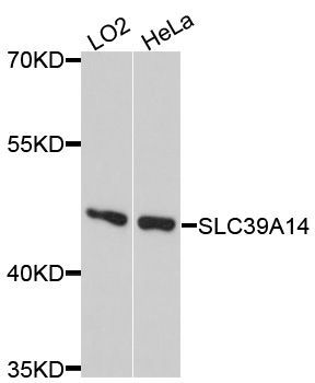 Western blot - SLC39A14 Polyclonal Antibody (144-10413)