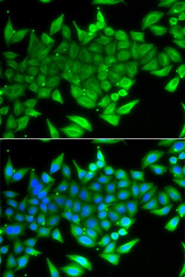 Immunofluorescence - TTF2 antibody (144-07751)