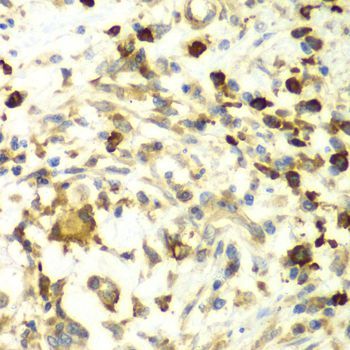 Immunohistochemistry - AIMP1 antibody (144-05301)