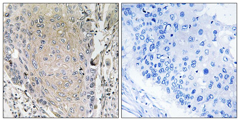 IHC