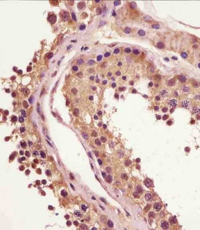 IHC-P