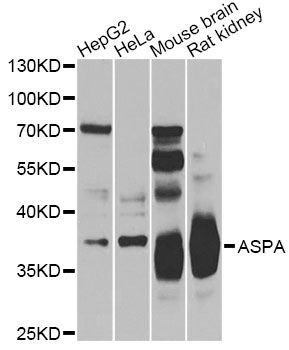 Western blot - ASPA Antibody (144-07271)