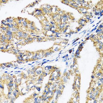 Immunohistochemistry - EPB41 antibody (144-02490)