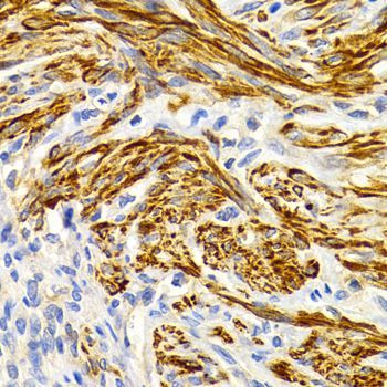 Immunohistochemistry - EDA Antibody (144-02905)