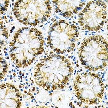 Immunohistochemistry - [KO Validated] HNRNPA2B1 Polyclonal Antibody (144-01162)