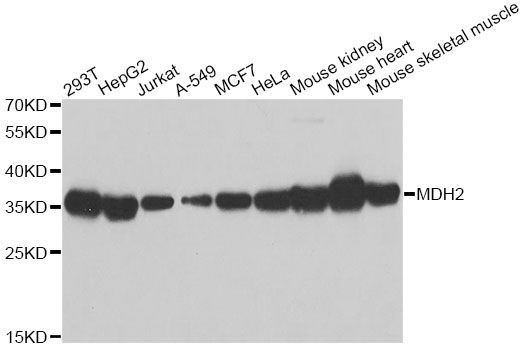Western blot - MDH2 antibody (144-013516)