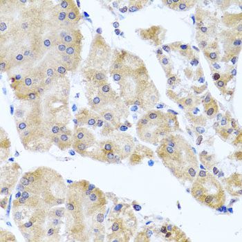 Immunohistochemistry - CETN3 antibody (144-08111)