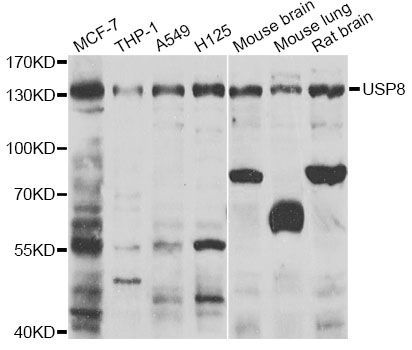 Western blot - USP8 Polyclonal Antibody (144-07031)