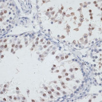 Immunohistochemistry - NOL3 Polyclonal Antibody (144-06319)