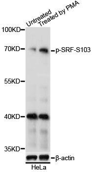 Western blot - Phospho-SRF-S103 pAb (144-61542)