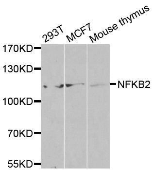 Western blot - NFKB2 Polyclonal Antibody (144-03108)