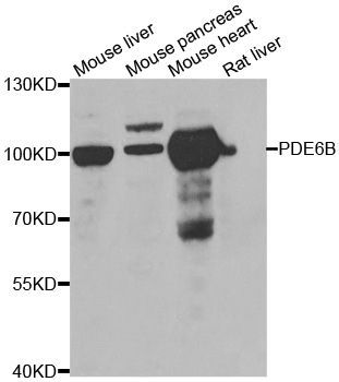 Western blot - PDE6B antibody (144-06942)