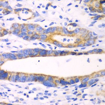 Immunohistochemistry - CHIA Polyclonal Antibody (144-61364)