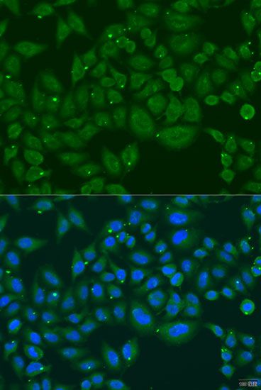 Immunofluorescence - INPP5K antibody (144-07807)