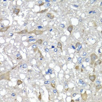 Immunohistochemistry - C1GALT1C1 antibody (144-07590)