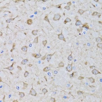 Immunohistochemistry - DFFA antibody (144-012431)