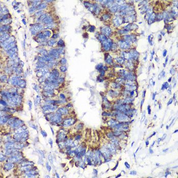 Immunohistochemistry - RALB antibody (144-61378)