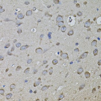 Immunohistochemistry - CKAP4 Polyclonal Antibody (144-07777)