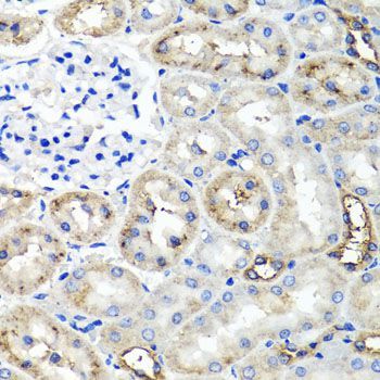 Immunohistochemistry - TNFAIP6 antibody (144-06419)