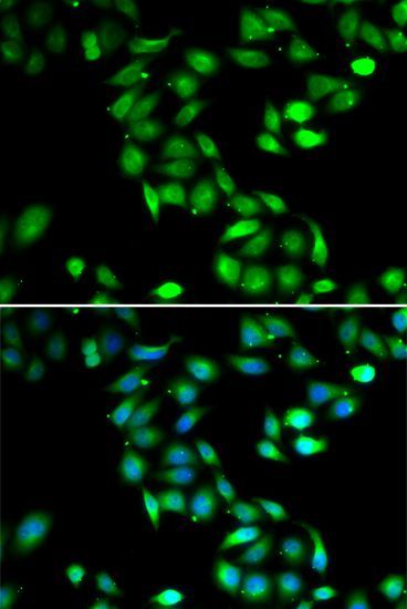 Immunofluorescence - PDCD6 Polyclonal Antibody (144-06685)