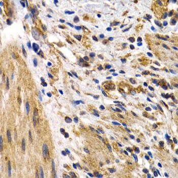 Immunohistochemistry - HSPB8 antibody (144-02514)