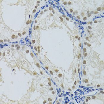 Immunohistochemistry - DDB1 Polyclonal Antibody (144-02896)