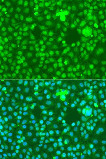 Immunohistochemistry - NOTCH1 Polyclonal Antibody (144-07636)