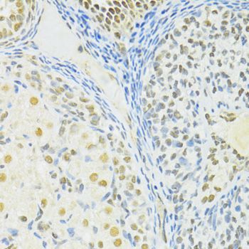 Immunohistochemistry - BRCA1 Polyclonal Antibody (144-11549)