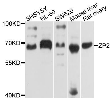 Western blot - ZP2 Polyclonal Antibody (144-10126)