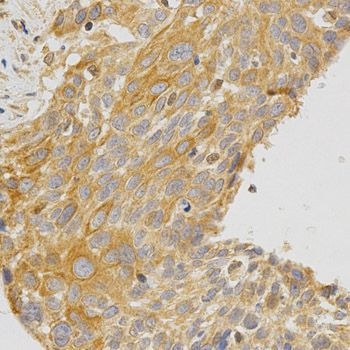 Immunohistochemistry - PRKCE antibody (144-02110)