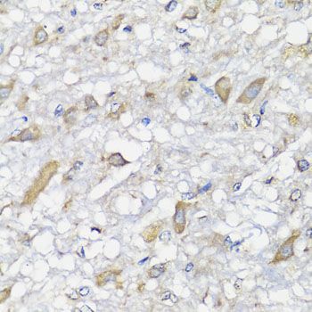 Immunohistochemistry - SPICE1 antibody (144-07855)