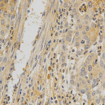 Immunohistochemistry - TNFRSF11B Polyclonal Antibody (144-02100)