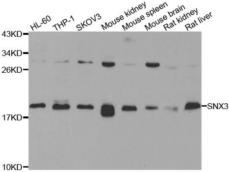 Western blot - SNX3 antibody (144-07502)