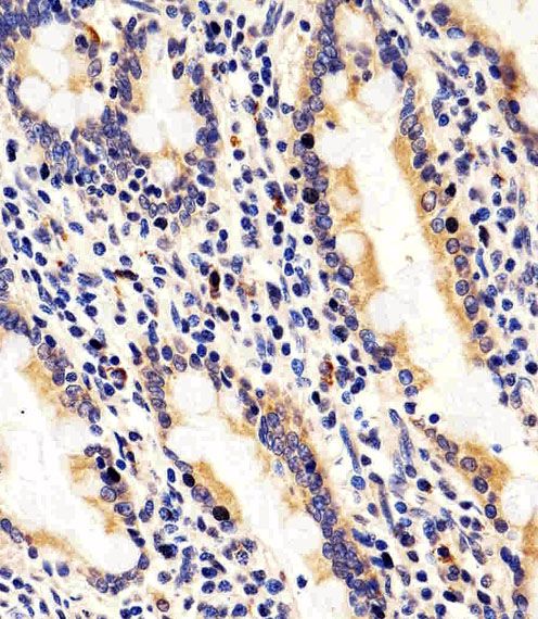IHC-P