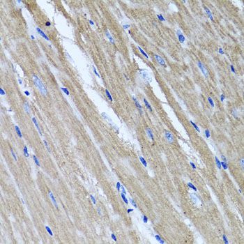 Immunohistochemistry - TNFAIP6 antibody (144-06419)