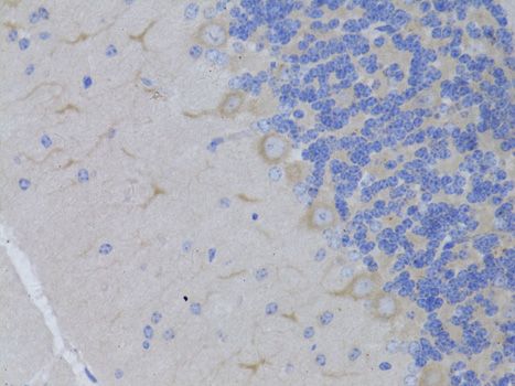 Immunohistochemistry - RARA Polyclonal Antibody (144-00370)