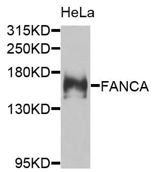 Western blot - FANCA Polyclonal Antibody (144-07671)