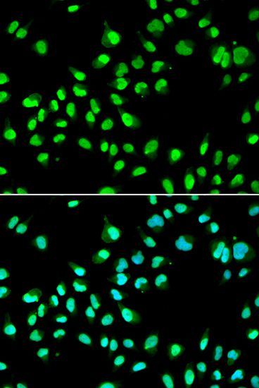 Immunofluorescence - GTF2F2 antibody (144-05826)