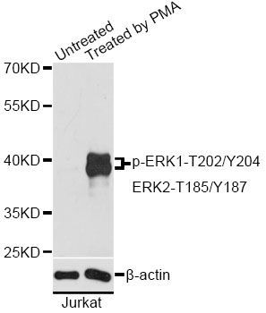 Western blot - Phospho-ERK1-T202/Y204 + ERK2-T185/Y187 pAb (144-50472)