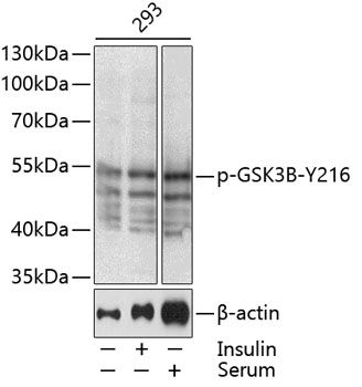 Western blot