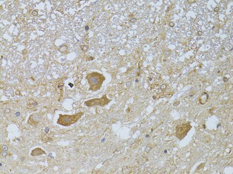 Immunohistochemistry - [KO Validated] HDAC8 Polyclonal Antibody (144-05829)