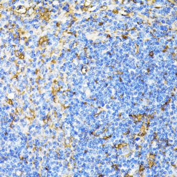 Immunohistochemistry - CD27 antibody (144-01945)
