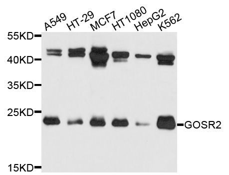 Western blot - GOSR2 antibody (144-04321)