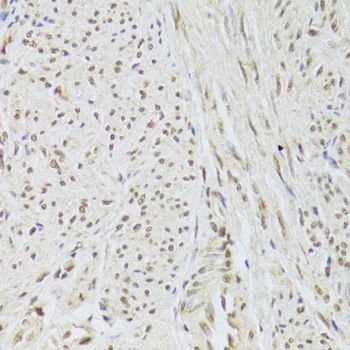 Immunohistochemistry - SNRPA Antibody (144-06410)