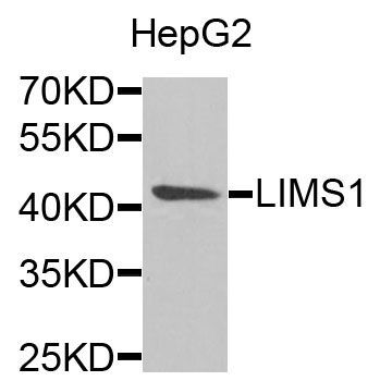 Western blot - LIMS1 Polyclonal Antibody (144-06384)
