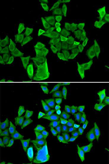 Immunofluorescence - CCAR1 antibody (144-013595)