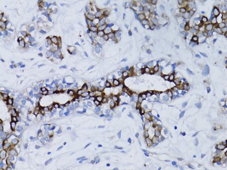 Immunohistochemistry - BRCA1 Polyclonal Antibody (144-00212)