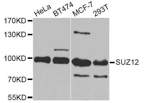 Western blot - [KO Validated] SUZ12 Polyclonal Antibody (144-07786)