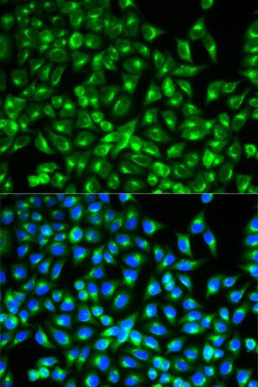 Immunofluorescence - CDC34 Polyclonal Antibody (144-05457)